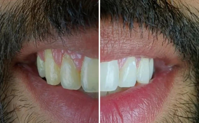 Top Smile Dental Clinic