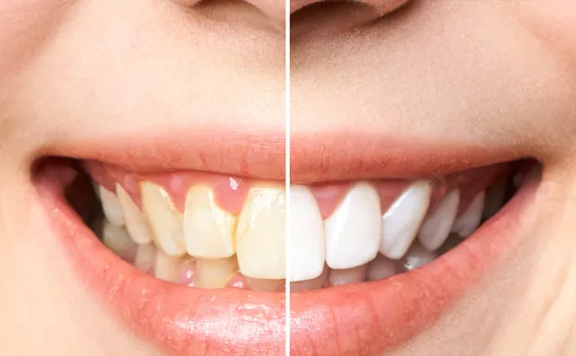 Top Smile Dental Clinic