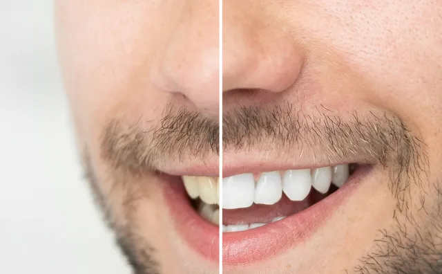 Top Smile Dental Clinic