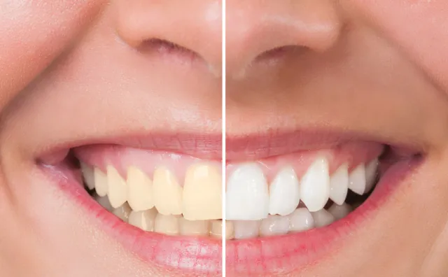 Top Smile Dental Clinic