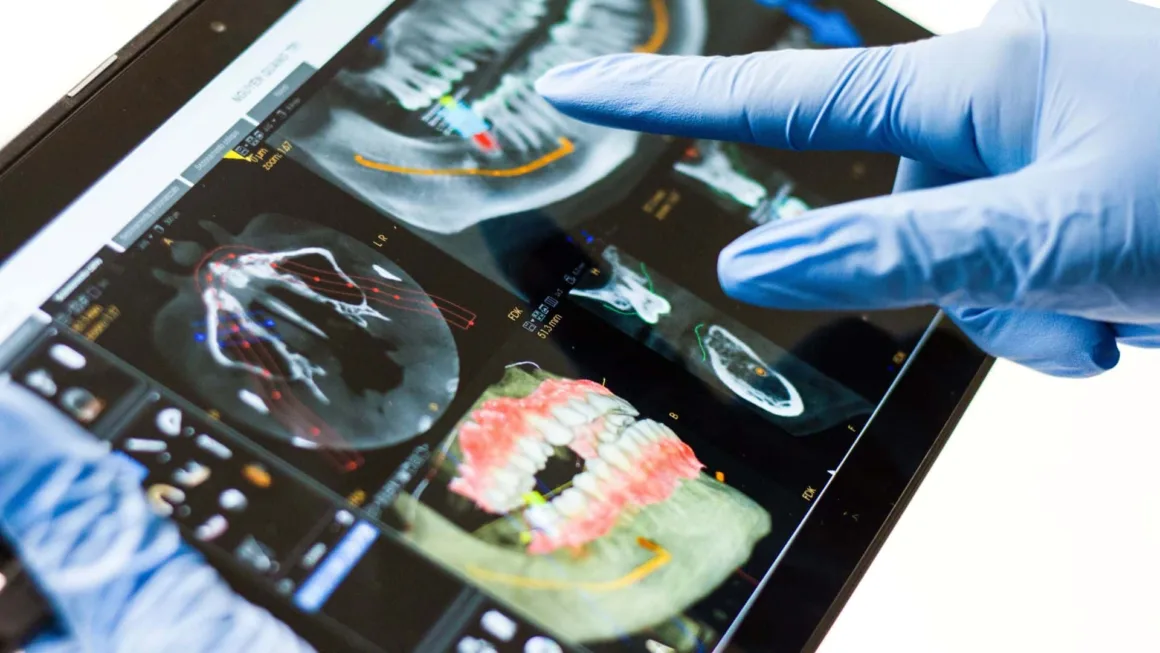 caries-removal-with-ultrasound caries removal