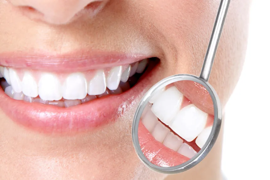 Tips for Your Healthy and Beautiful Smile