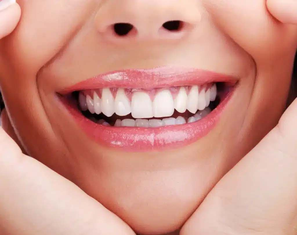 smile design | the dental studio dubai