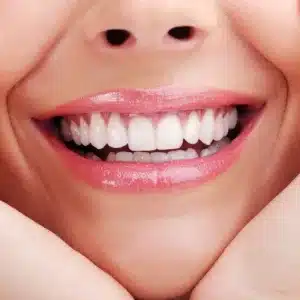 smile design | the dental studio dubai