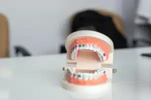 Dental Braces & Invisalign Dubai