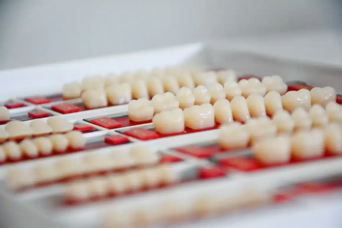 dental crown dental crown | dentist dubai
