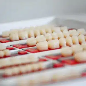 dental crown | dentist dubai