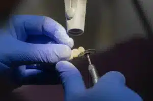 Dentures Dubai