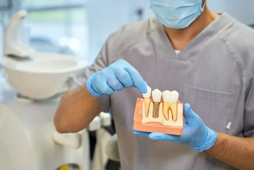 dental implants cost in dubai