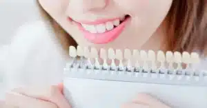 veneers-crown-cost