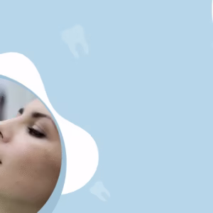 Teeth Implants in Dubai