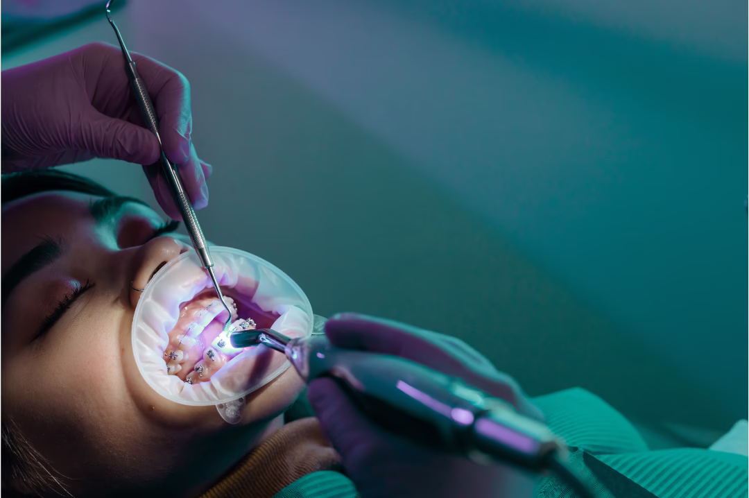 root canal treatment dubai
