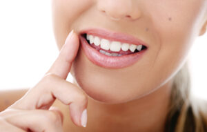 HollyWood Smile Design