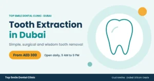 Tooth extraction dubai top smile dental clinic